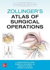 Zollinger's Atlas Of Surgical Operations, Eleventh Edition 11Th Edition hind ja info | Võõrkeele õppematerjalid | kaup24.ee
