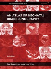 Atlas Of Neonatal Brain Sonography - Clinics In Developmental Medicine 2Nd Edition цена и информация | Пособия по изучению иностранных языков | kaup24.ee