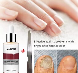 Сыворотка для восстановления ногтей, 15мл цена и информация | Лаки для ногтей, укрепители для ногтей | kaup24.ee