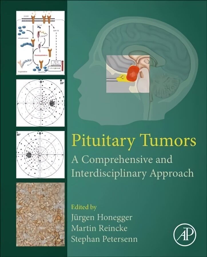 Pituitary Tumors: A Comprehensive and Interdisciplinary Approach цена и информация | Majandusalased raamatud | kaup24.ee