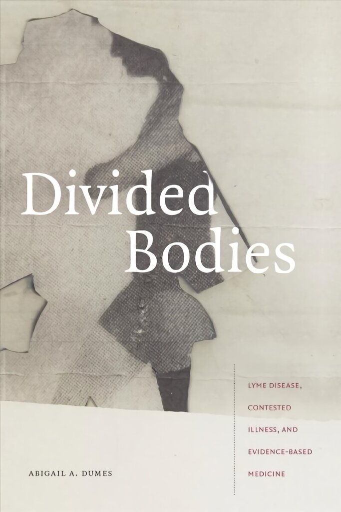 Divided Bodies: Lyme Disease, Contested Illness, and Evidence-Based Medicine hind ja info | Ühiskonnateemalised raamatud | kaup24.ee