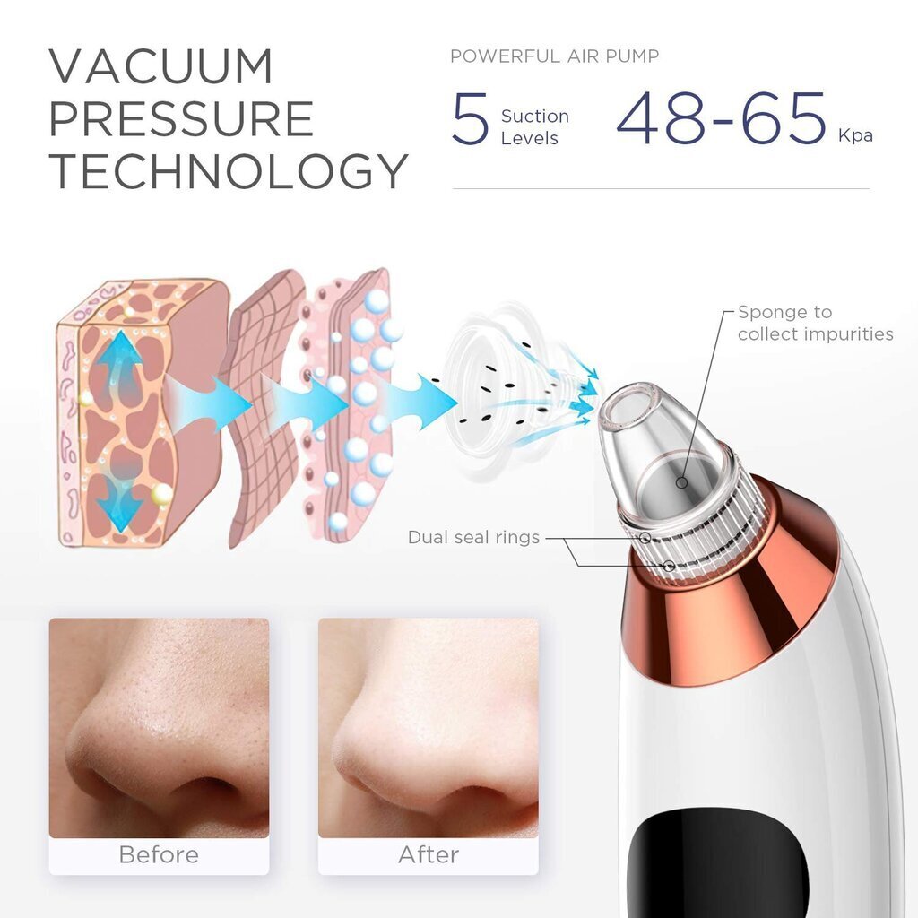 Zknen 5 kiirused Blackhead Remover vaakum/nägu pooride puhastaja / näo poorid vaakum akne vistrik eemaldamine vaakum imemise tööriist / face skin LED -valgusravi ja küttefunktsiooniga цена и информация | Näohooldusseadmed | kaup24.ee