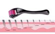 Nõelrull - dermaroller Derma Roller 0,5 mm hind ja info | Näopuhastus- ja massaažiseadmed | kaup24.ee