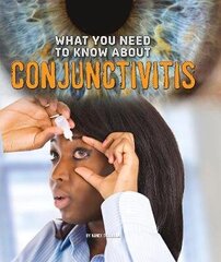 What You Need to Know about Conjunctivitis hind ja info | Noortekirjandus | kaup24.ee