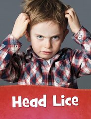 Head Lice hind ja info | Noortekirjandus | kaup24.ee