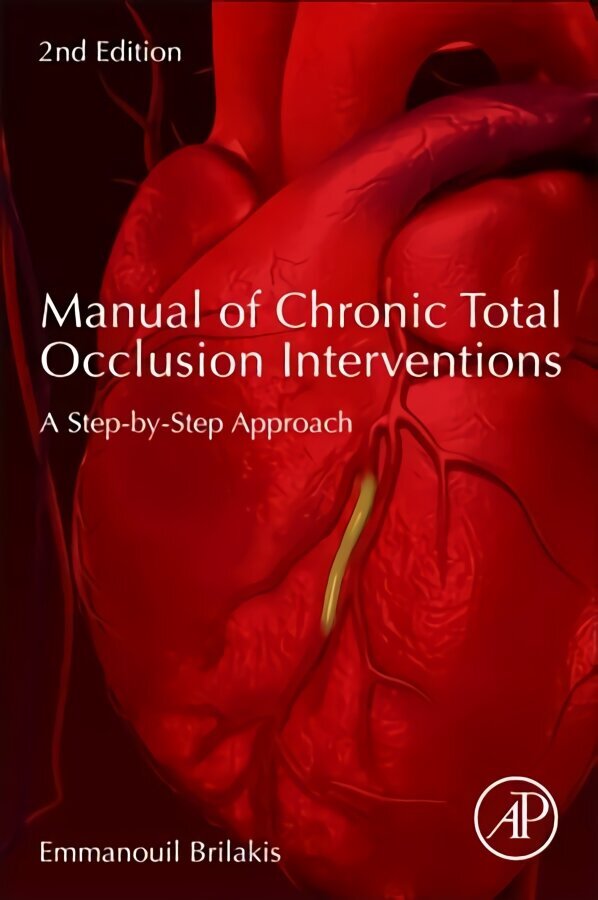 Manual of Chronic Total Occlusion Interventions: A Step-by-Step Approach 2nd edition hind ja info | Majandusalased raamatud | kaup24.ee