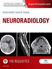 Neuroradiology: The Requisites 4th edition hind ja info | Majandusalased raamatud | kaup24.ee