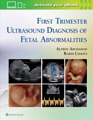 First Trimester Ultrasound Diagnosis of Fetal Abnormalities цена и информация | Книги по экономике | kaup24.ee