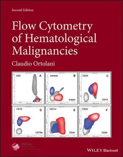 Flow Cytometry of Hematological Malignancies 2nd Edition цена и информация | Majandusalased raamatud | kaup24.ee