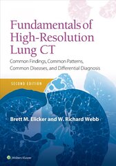 Fundamentals of High-Resolution Lung CT: Common Findings, Common Patterns, Common Diseases and Differential Diagnosis 2nd edition цена и информация | Книги по экономике | kaup24.ee