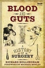 Blood and Guts: A History of Surgery цена и информация | Книги по экономике | kaup24.ee