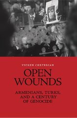 Open Wounds: Armenians, Turks, and a Century of Genocide hind ja info | Ajalooraamatud | kaup24.ee