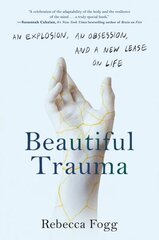 Beautiful Trauma: An Explosion, an Obsession, and a New Lease on Life hind ja info | Ühiskonnateemalised raamatud | kaup24.ee