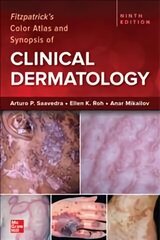 Fitzpatrick's Color Atlas and Synopsis of Clinical Dermatology, Ninth Edition 9th edition цена и информация | Книги по экономике | kaup24.ee