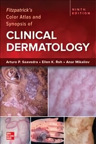 Fitzpatrick's Color Atlas and Synopsis of Clinical Dermatology, Ninth Edition 9th edition цена и информация | Majandusalased raamatud | kaup24.ee