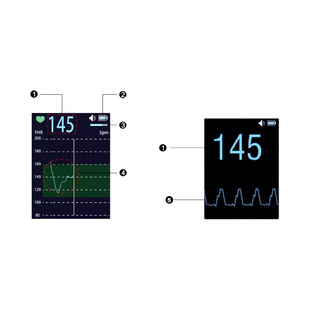 Допплер-детектор частоты сердцебиения плода Jumper Medical JPD-100E цена |  kaup24.ee