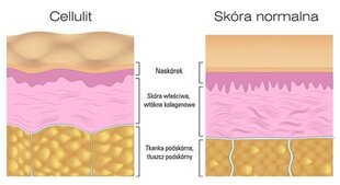 Kreemid tselluliidi- ja venitusarmide jaoks Bingapaa hind ja info | Kehakreemid, kehaspreid | kaup24.ee