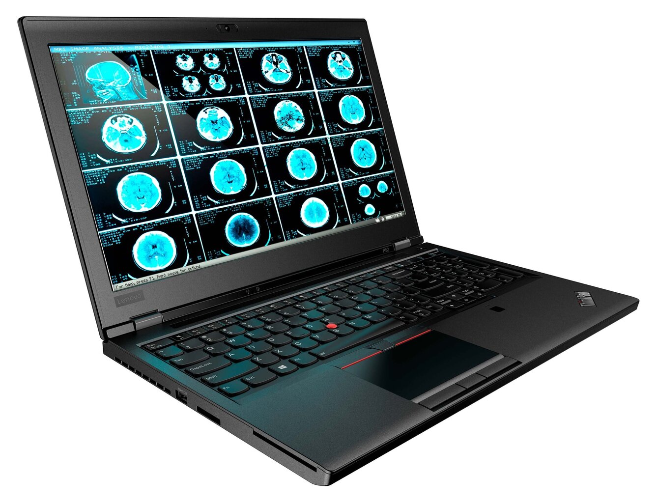 Lenovo ThinkPad P52;i7-8850H|32Gb|Quadro P2000 4Gb|15.6 Fhd Ips|512Gb Ssd + 1Tb Hdd|Windows 11 Pro|Uuendatud/Renew hind ja info | Sülearvutid | kaup24.ee