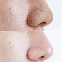 Очищающие пластыри для носа, 10 шт. цена и информация | Маски для лица, патчи для глаз | kaup24.ee
