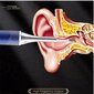 EnjoyE5 kõrvahoolduse nutikas endoskoop цена и информация | Näohooldusseadmed | kaup24.ee