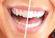 U-Smiler 359571 hind ja info | Elektrilised hambaharjad | kaup24.ee