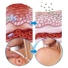 Salv tüügaste eemaldamiseks Ifory, 2 x 20 g цена и информация | Мази, бальзамы | kaup24.ee