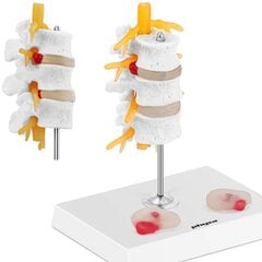 Lülisamba nimmeosa 3D anatoomiline mudel herniaalsete selgroolülidega Physa hind ja info | Arendavad mänguasjad | kaup24.ee