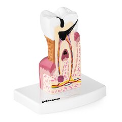 Haigestunud inimese hamba anatoomiline mudel цена и информация | Развивающие игрушки | kaup24.ee