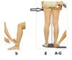 Meditsiinilised kompressioonsukad Avicenum 140, CCL-1, 18-21 mm Hg, must цена и информация | Liigesetoed ja -kaitsmed | kaup24.ee