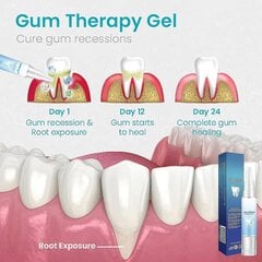 Gum Shield ravigeel, igemeravigeel, hambavalgenduse essentspliiats, hambavalgenduspliiats, hambaplekieemaldaja tundlikele hammastele 5 tk. hind ja info | Suuhügieen | kaup24.ee