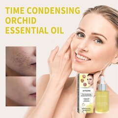 1-3 tk Orhidee akne eemaldamise eeterlik õli Comedo aknemärgid vistrikuid puhastav seerum Brighten Facial Repair Essence 30 ml цена и информация | Аппараты для ухода за лицом | kaup24.ee