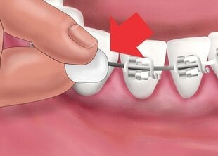 Vaha peegliga Ortho (spetsiaalselt ortodontiliste seadmete kasutajatele) G.U.M.® (723) цена и информация | Для ухода за зубами | kaup24.ee