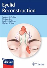 Eyelid Reconstruction цена и информация | Энциклопедии, справочники | kaup24.ee