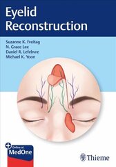 Eyelid Reconstruction hind ja info | Entsüklopeediad, teatmeteosed | kaup24.ee