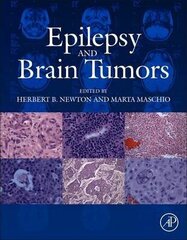 Epilepsy And Brain Tumors hind ja info | Entsüklopeediad, teatmeteosed | kaup24.ee