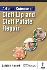 Art And Science Of Cleft Lip And Cleft Palate Repair hind ja info | Entsüklopeediad, teatmeteosed | kaup24.ee