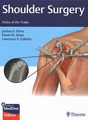 Shoulder Surgery: Tricks Of The Trade hind ja info | Entsüklopeediad, teatmeteosed | kaup24.ee