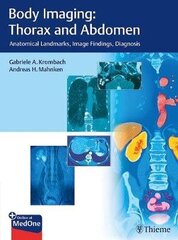 Body Imaging: Thorax And Abdomen: Anatomical Landmarks, Image Findings, Diagnosis цена и информация | Энциклопедии, справочники | kaup24.ee
