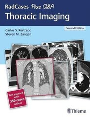Radcases Plus Q&a Thoracic Imaging 2Nd New Edition hind ja info | Romaanid  | kaup24.ee