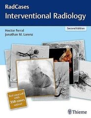 Radcases Q&a Interventional Radiology 2Nd New Edition цена и информация | Энциклопедии, справочники | kaup24.ee