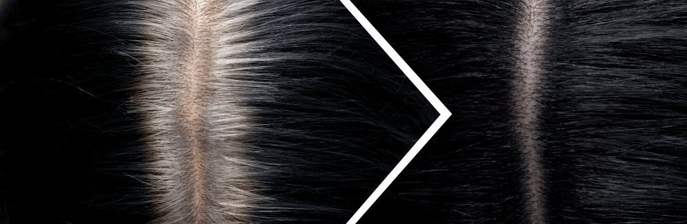 Noorendav pihustatav juuksejuure peitja L'Oreal Paris Magic Retouch Dark Brown 75 ml hind ja info | Juuksevärvid | kaup24.ee