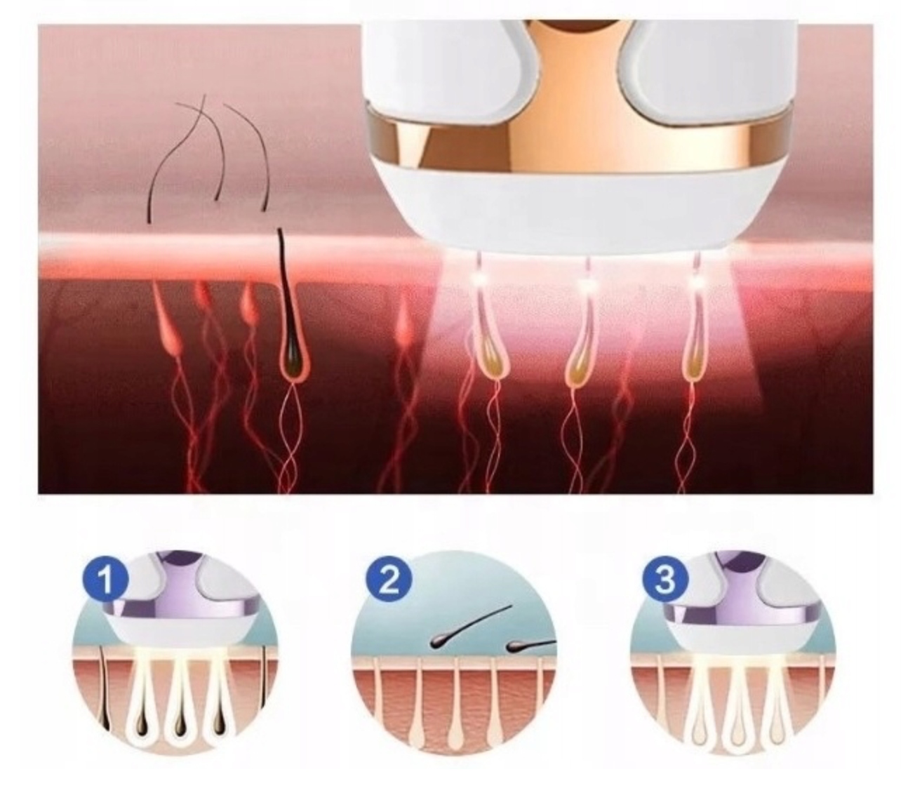 IPL LASER Epilaator KINGITUS 999999 FLASHES Toitevõrgust